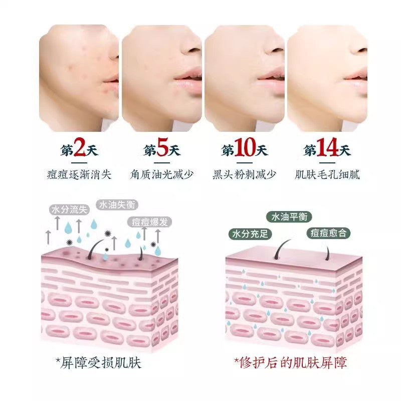 Guangyao Baiyunshan Baidi Bio Salicylic Acid Essence Shrinks Pores, Exfoliates, Removes Acne and Blackheads, Hydrating Essence