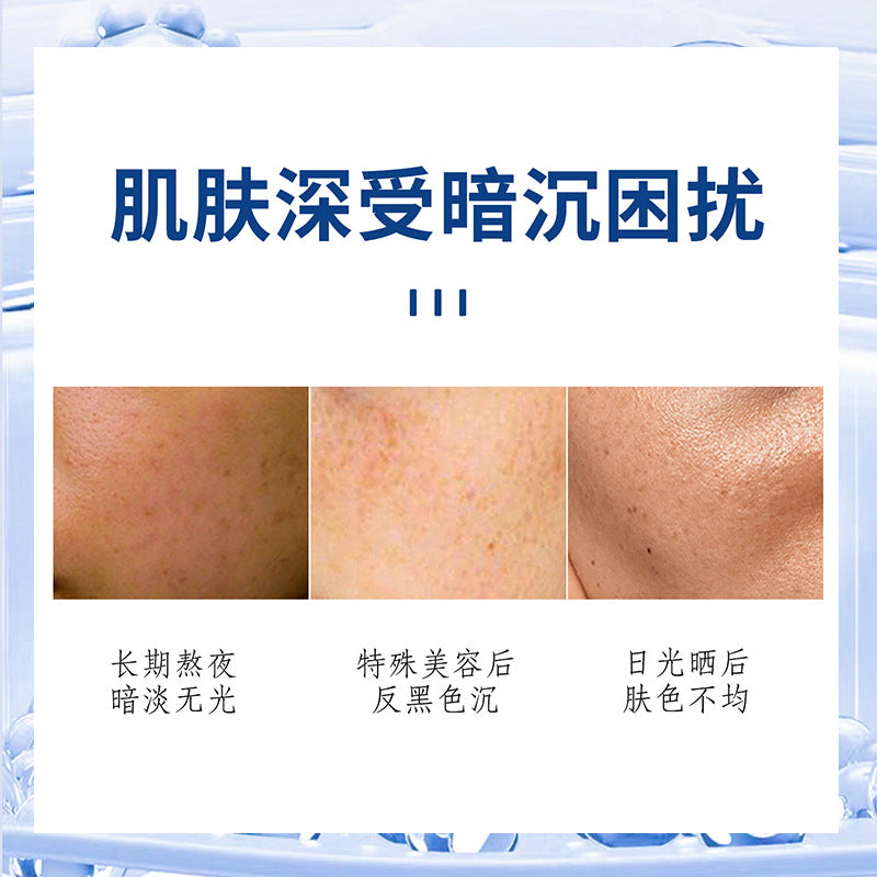 Ioeo Tranexamic Acid and Niacinamide Essence Improves Dullness and Yellow Skin Essence Tranexamic Acid Niacinamide Essence